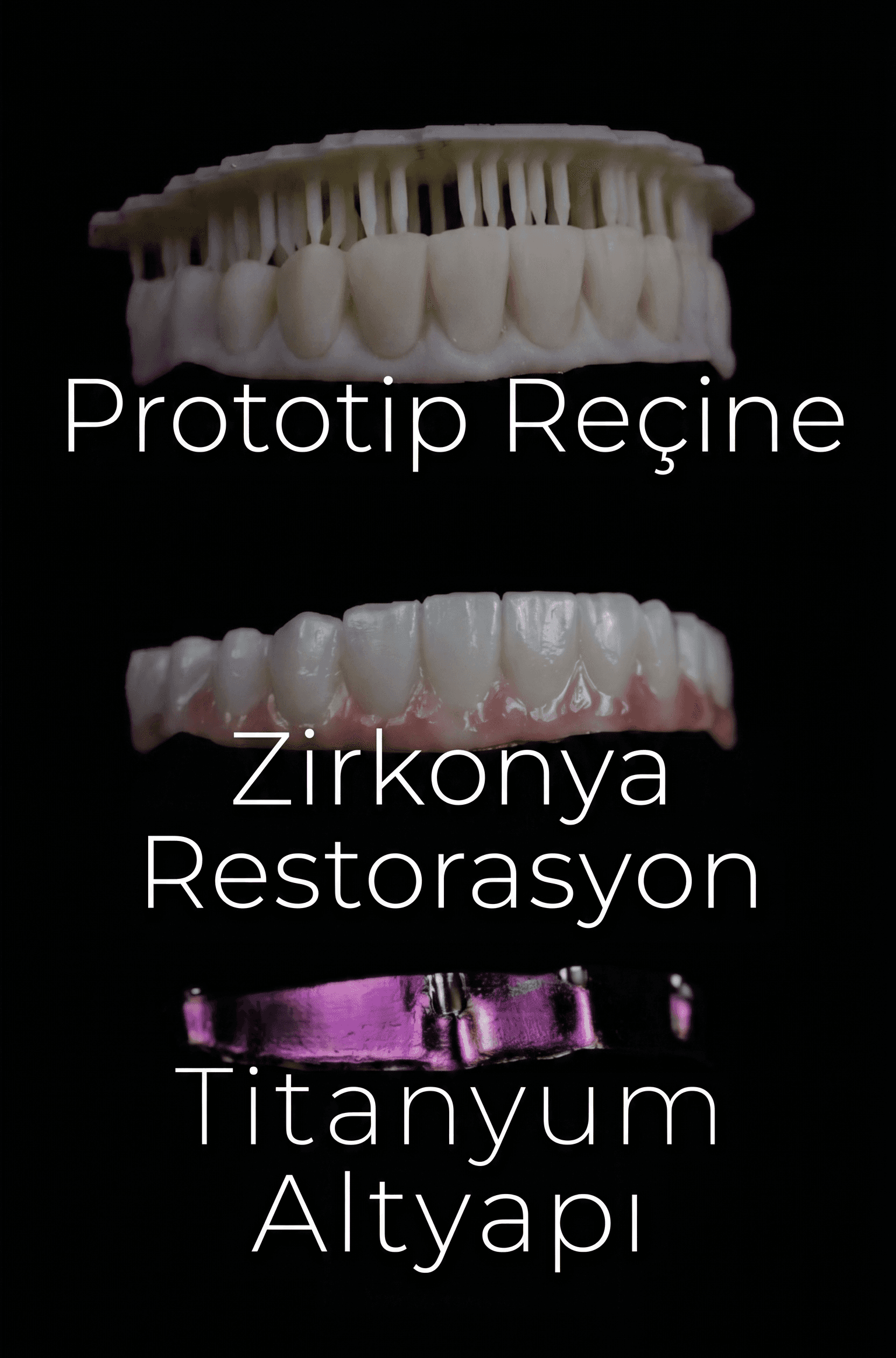 Minimal implant restoration planning geometry