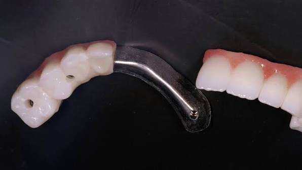 Clean implant restoration components